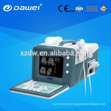2d ultrasound machines& ultrasound scanner for abdomen,liver,gallbladder,pancreas,spleen,kidney,uterus,bladder DW330
